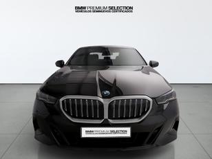 Fotos de BMW Serie 5 520d color Negro. Año 2024. 145KW(197CV). Diésel. En concesionario Automotor Premium Marbella - Málaga de Málaga